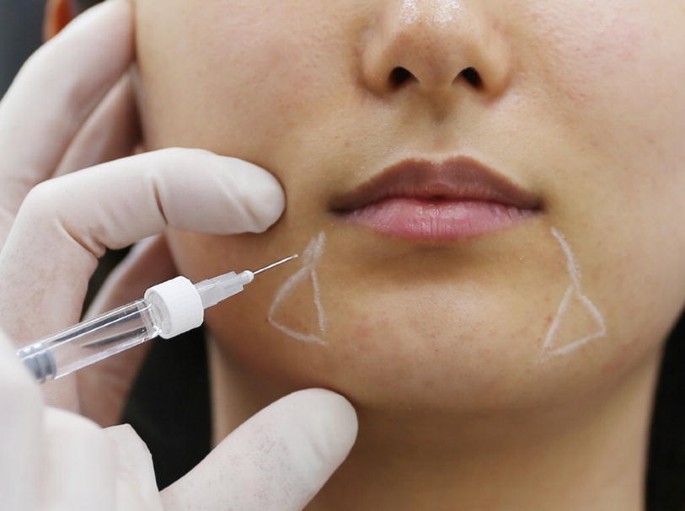 acido hialuronico marioneta dra mercedes lamela las palmas maspalomas