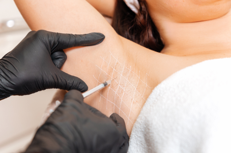 Botox Hiperhidrosis dra mercedes lamela las palmas maspalomas