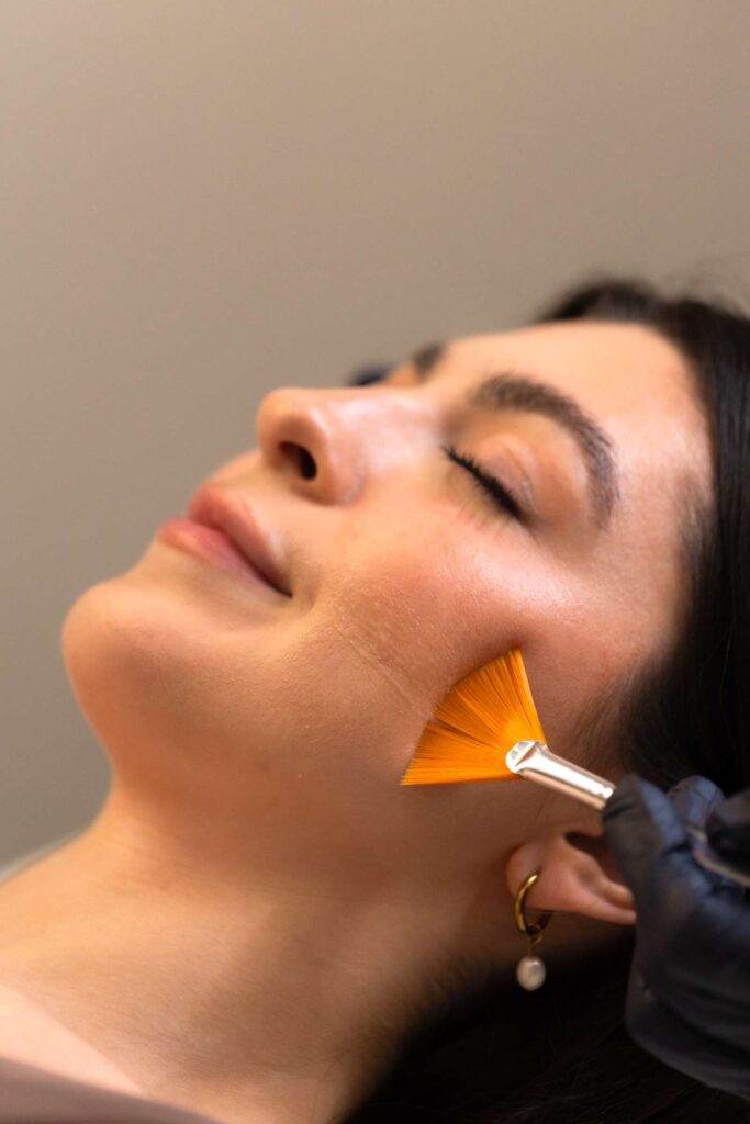 peeling dra mercedes lamela las palmas maspalomas