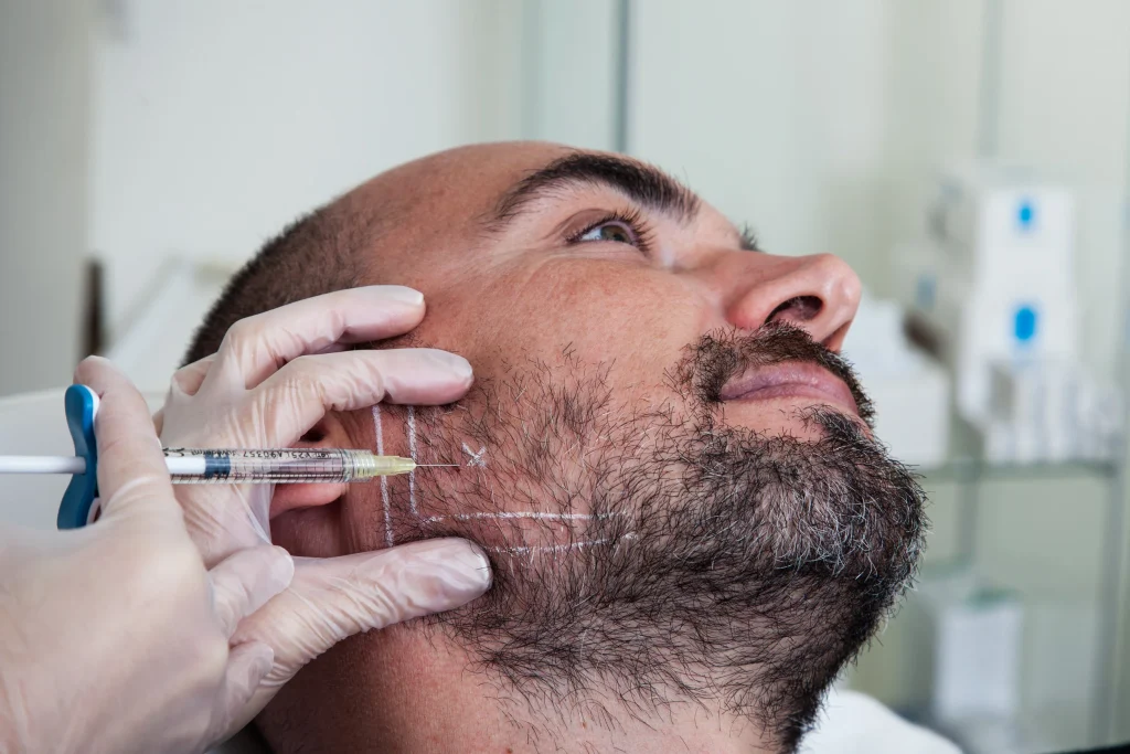 acido hialuronico marcacion mandibular dra mercedes lamela las palmas maspalomas