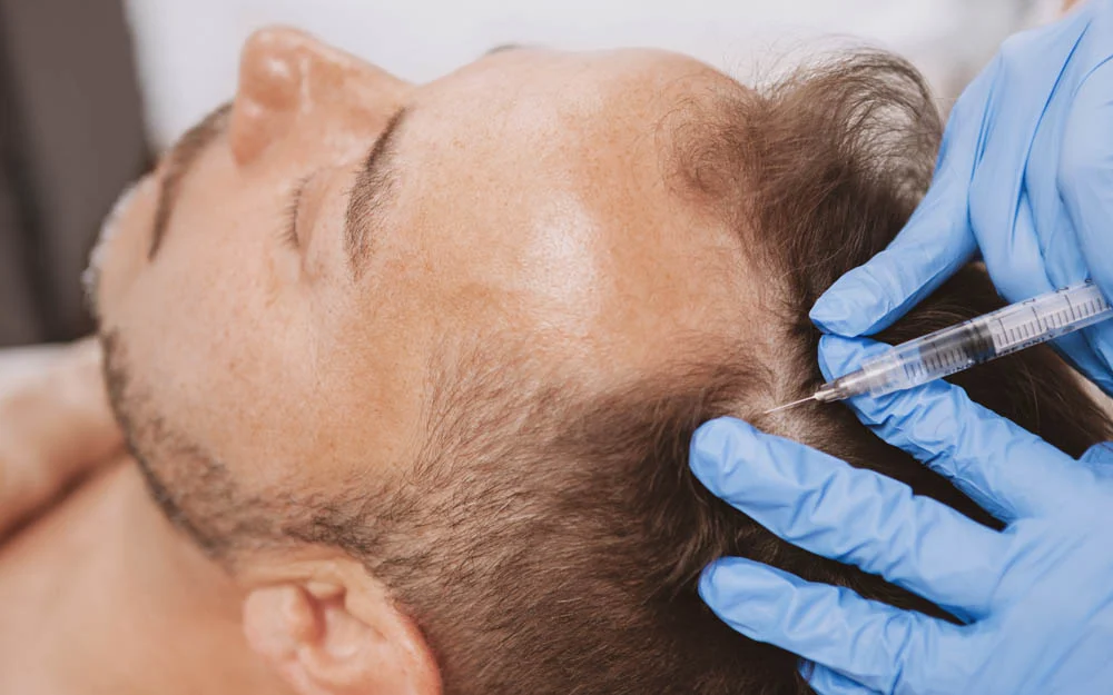 antiandrogenos dutasteride dra mercedes lamela las palmas